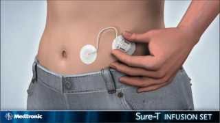 medtronic quick set instructions